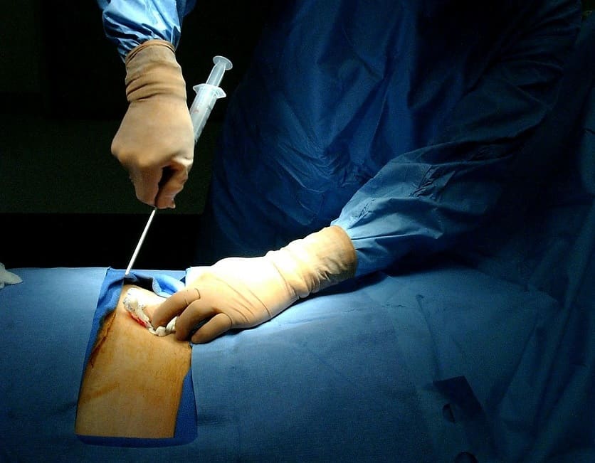 Cadastro de doadores de medula na Aldeia Caieiras Velha em Aracruz