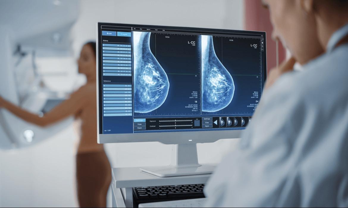 Mulheres de Aracruz terão acesso a cerca de mil exames com Carreta da Ultrassonografia